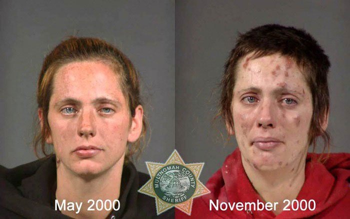 antes-despues-drogas10