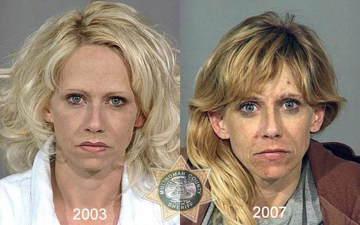 antes-despues-drogas13