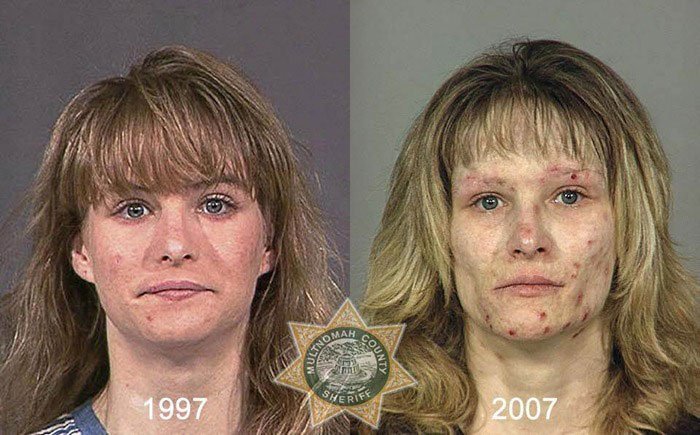 antes-despues-drogas18