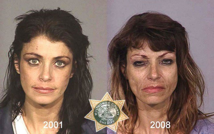 antes-despues-drogas2