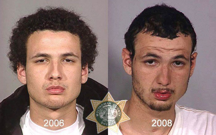 antes-despues-drogas20