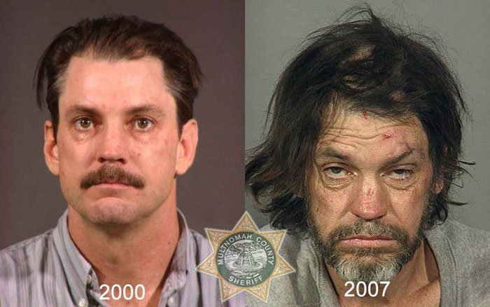 antes-despues-drogas3