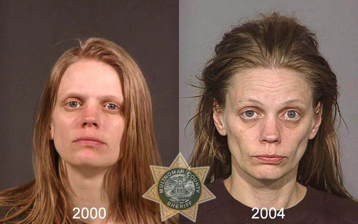 antes-despues-drogas6