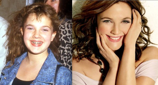 celebridades-brackets1