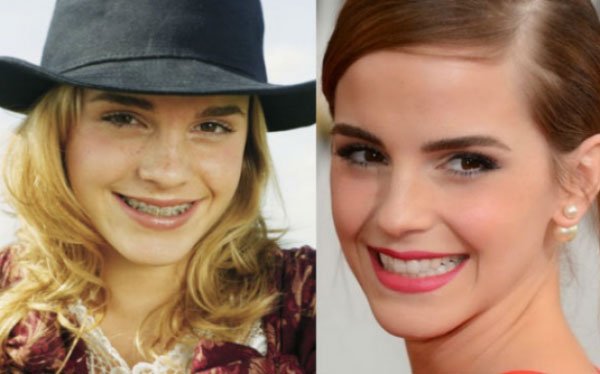 celebridades-brackets2