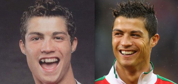 celebridades-brackets3