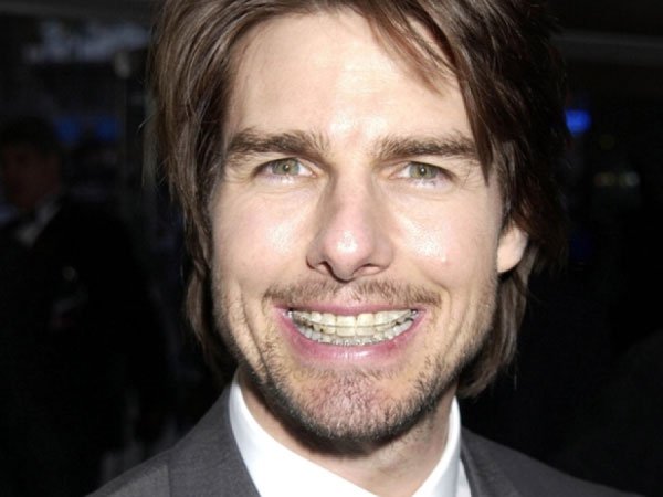 celebridades-brackets6