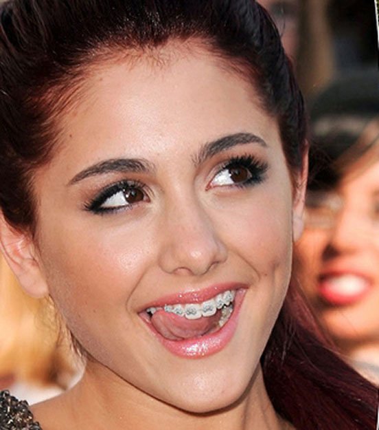 celebridades-brackets9