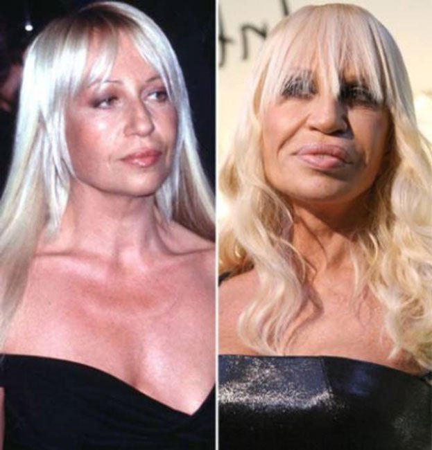 cirugia-estetica-fail1