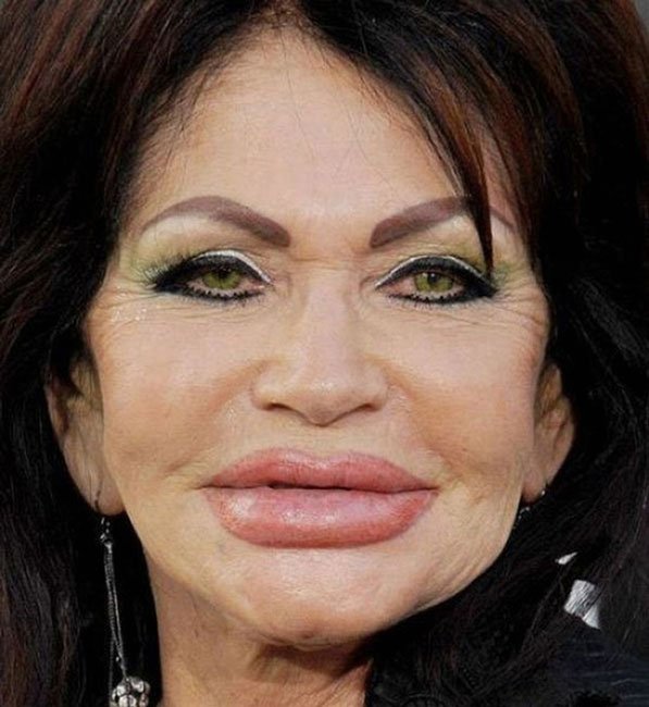 cirugia-estetica-fail10