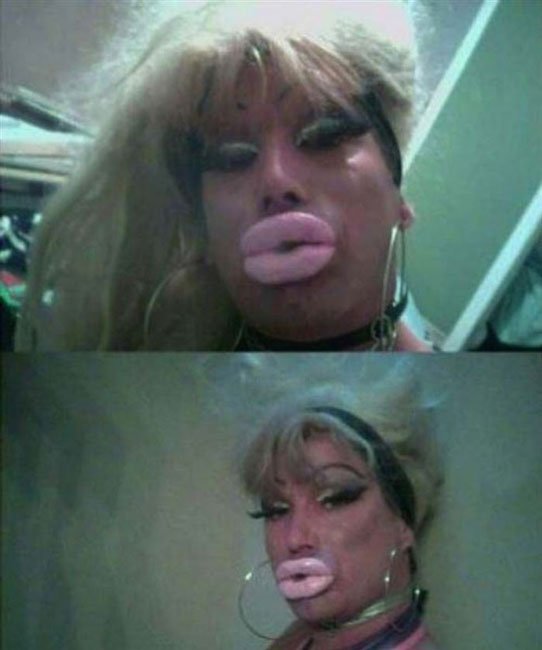 cirugia-estetica-fail9