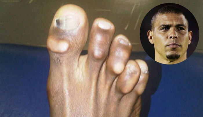 pies-futbolistas7