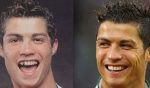Famosos con brackets