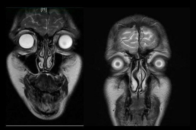 imagen-resonancia-magnetica2